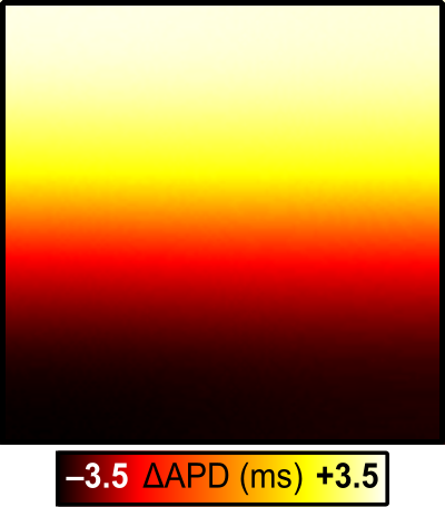 05c_regions_vs_gradients/02_05A_Regions_vs_Gradients_Fig5_DeltaAPD.png