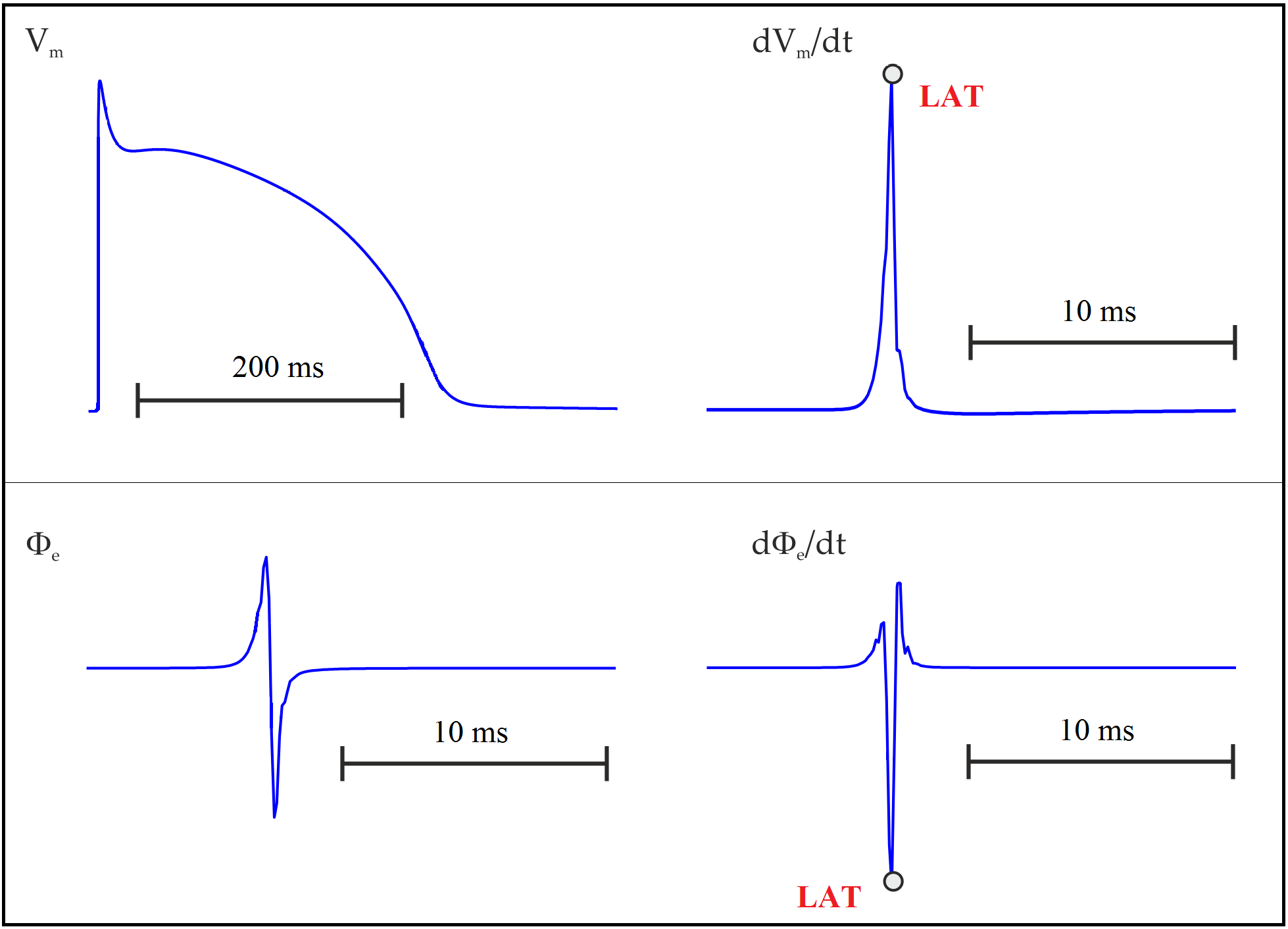 Action potential in an uncoupled cell. Upper panel: transmembrane potential V_{\mathrm m} and its time derivative \mathrm{d}V_{\mathrm m}/\mathrm{d}t. Lower panel: extracellular potential \phi_{\mathrm e} and its time derivative \mathrm{d}\phi_{\mathrm e}/\mathrm{d}t. LAT is usually taken as the time of maximum \mathrm{d}V_{\mathrm m}/\mathrm{d}t or the minimum \mathrm{d}\phi_{\mathrm e}/\mathrm{d}t.