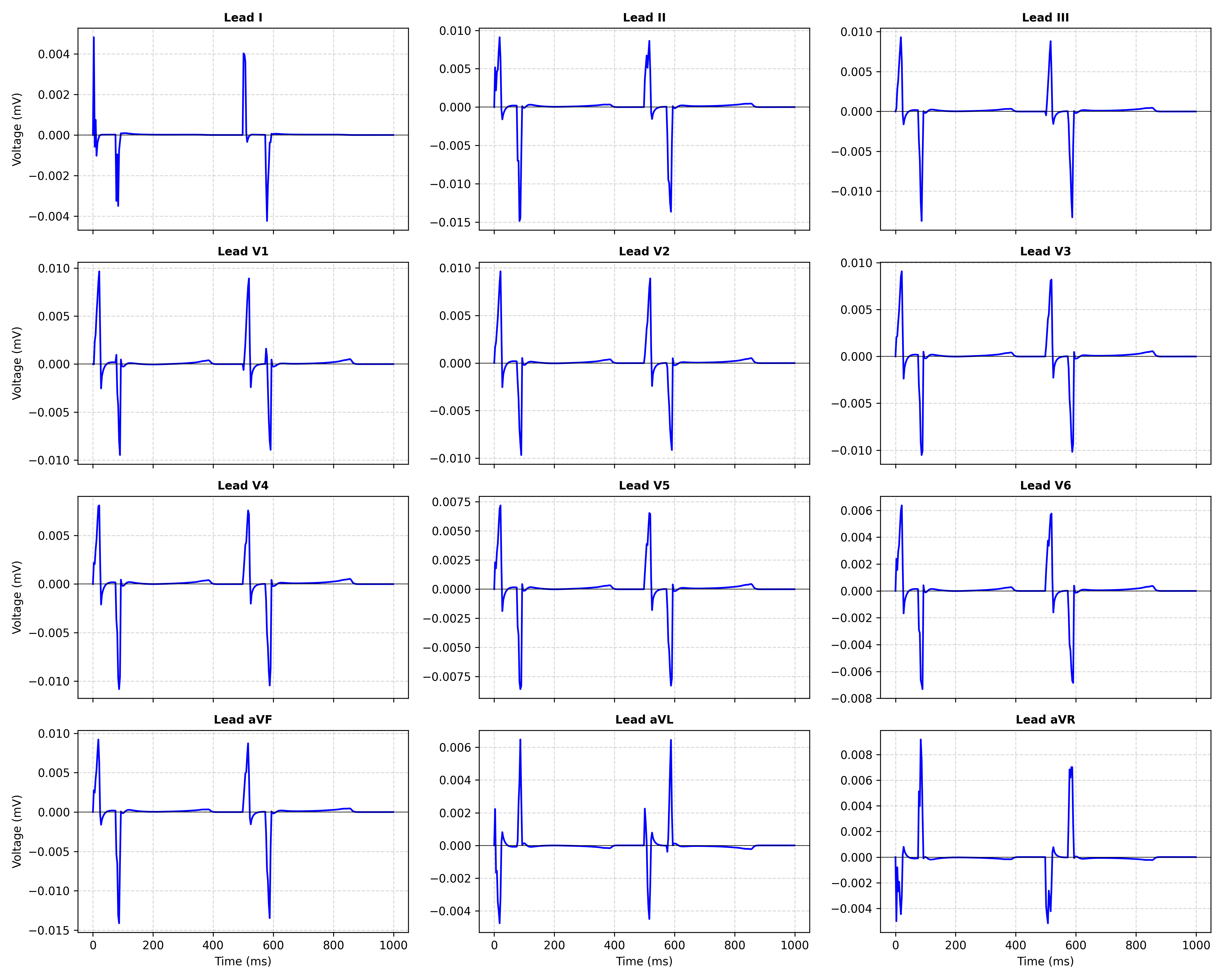 09_leadfield/02_09_summary_ecg.png